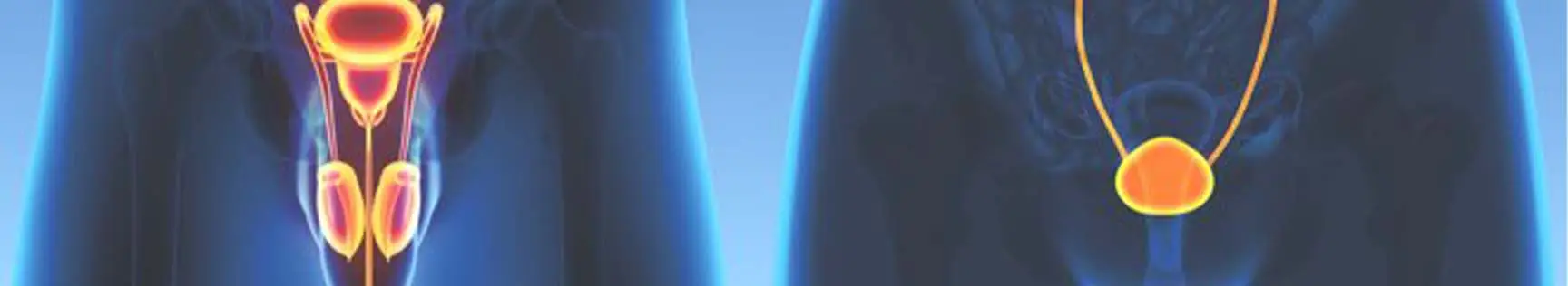 banner img